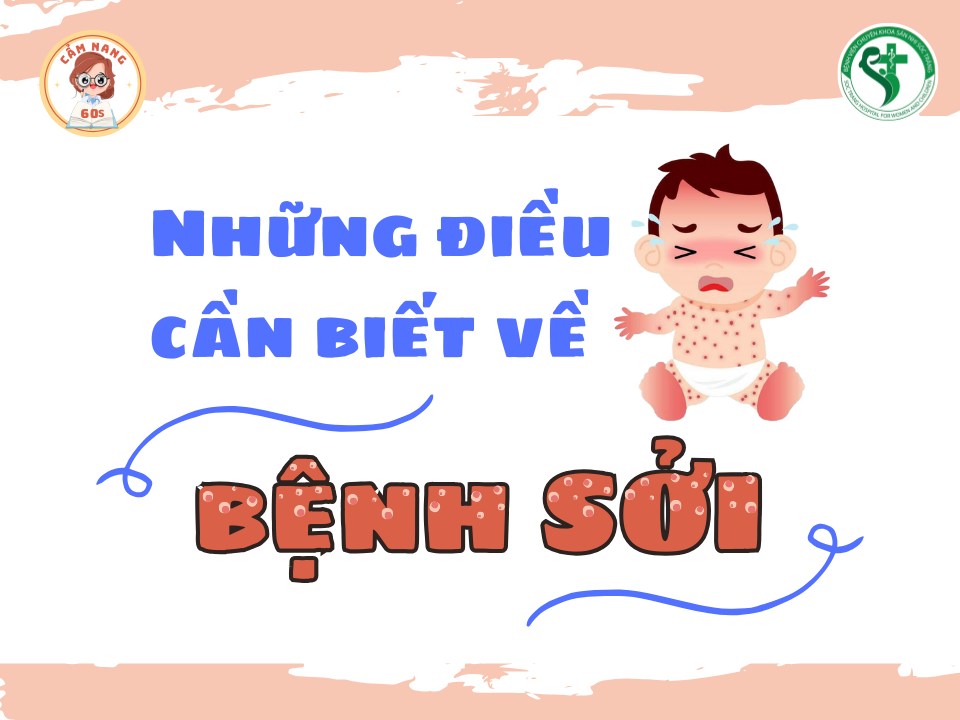 CẨM NANG 60s: NHỮNG ĐIỀU CẦN BIẾT VỀ BỆNH SỞI